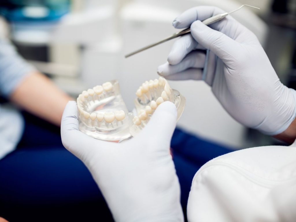 dentalni implanti