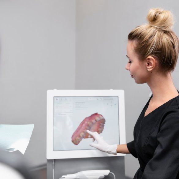 3d cbct snimanje zuba;