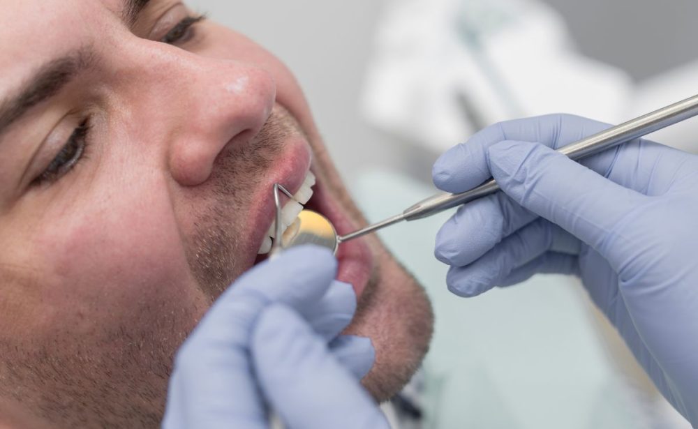 popravka i zamena starih zubnih radova